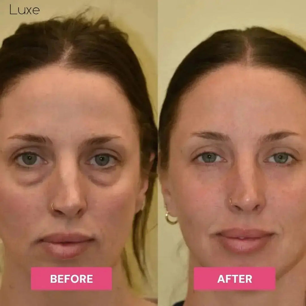 Luxe Research | Brightening Under-Eye Balm