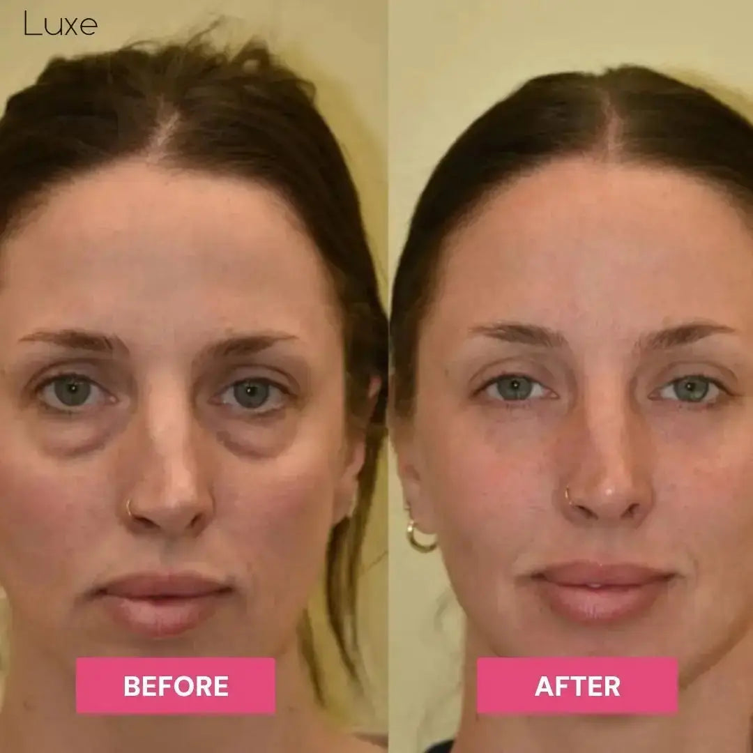 Luxe Research | Brightening Under-Eye Balm